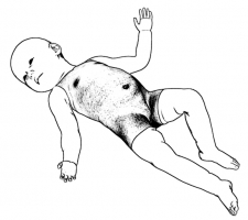 supine head rotation.jpg