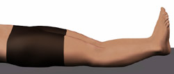 knee hyperextension supine.jpg